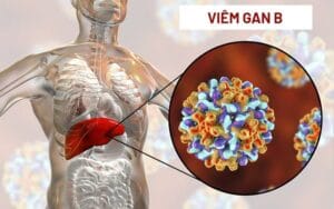 Sự thật hay lời đồn? Xáo tam phân và công dụng hỗ trợ điều trị viêm gan B