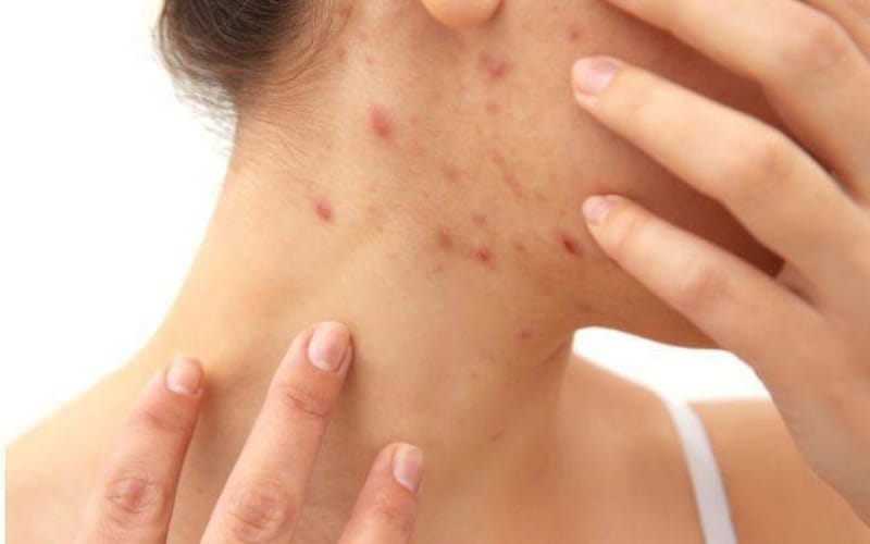 Xáo tam phân và các loại trà thanh lọc giúp thải độc cơ thể